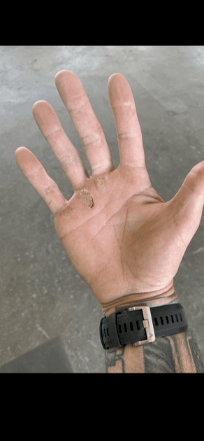Hands ripped and dry
