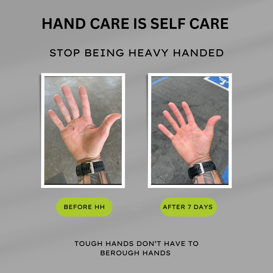 Hand Care Is Self Care — Even If You’re Not Into That Kind of Thing